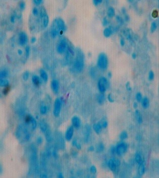 BAAR en célula macrofágica