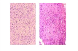 Corte histológico de ganglio